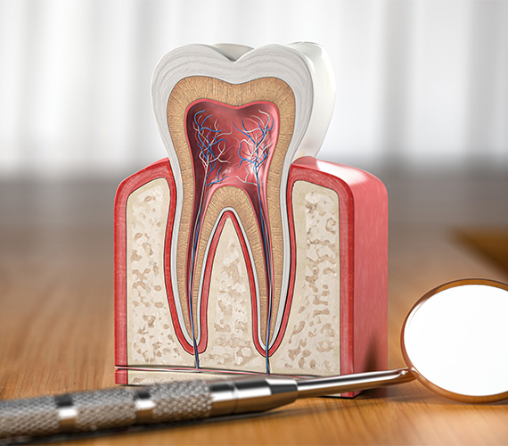 根管治療（歯内療法）